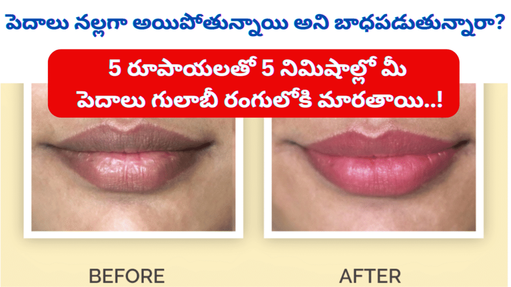 Dark Lips Removal Cream for Soft, Pink Lips